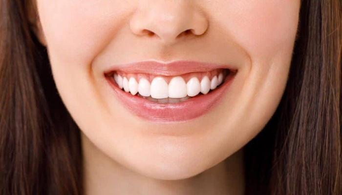 Teeth Whitening in Mumbai – Dr. Aditi Chhajed