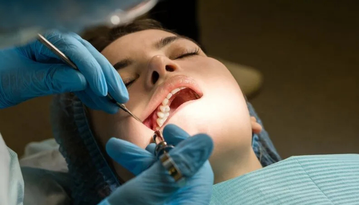 Dental Implants in Mumbai – Dr. Aditi Chhajed