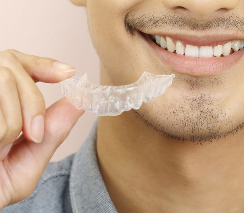 Conditions Treated by Invisalign